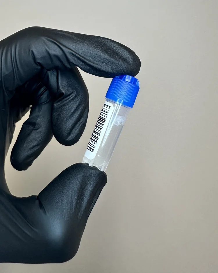 Clinical professional holding a saliva sample for diagnostic oral health testing.