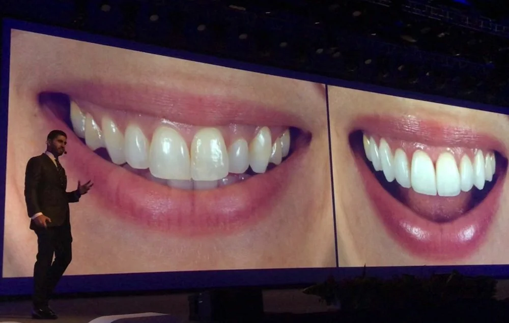 Dental professional presenting a smile makeover case study on a large screen.