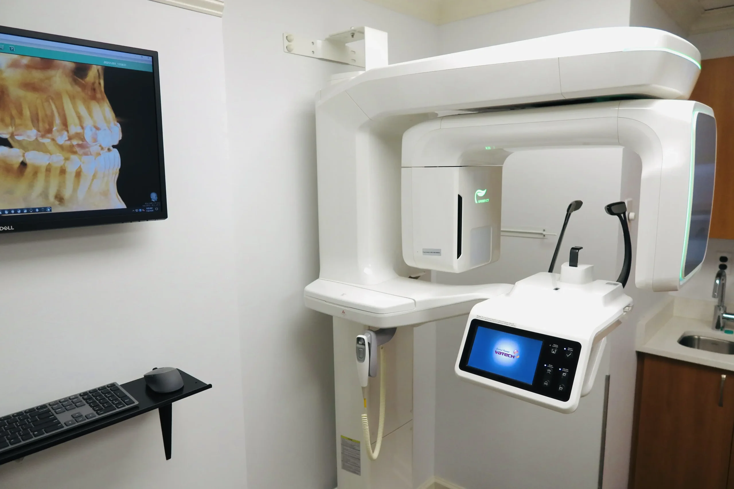 High-tech dental CT scan imaging equipment ready for patient diagnostic use.