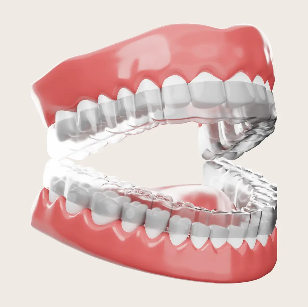 Clear custom dental nightguard for teeth grinding and TMJ protection.