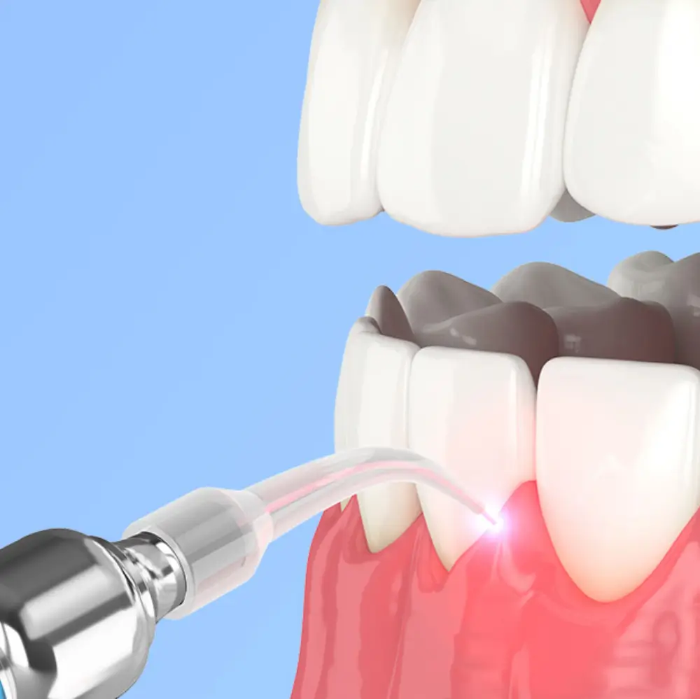 Patient receiving dental sedation treatment during a clinical procedure.