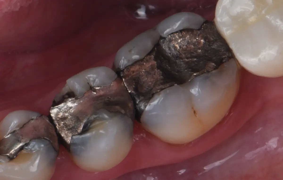 amalgam image for services list
